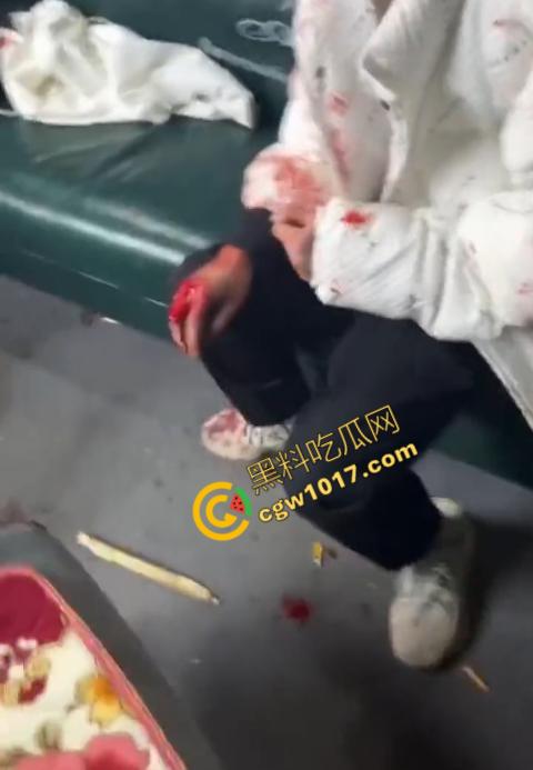 血腥慎点!社会混混残忍虐打小伙,马桶刷戳脸,铁管刺手,手背戳破血肉模糊,骨头暴露,惨不忍睹,令人心寒!-8