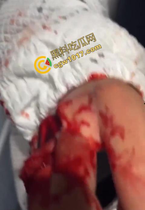 血腥慎点!社会混混残忍虐打小伙,马桶刷戳脸,铁管刺手,手背戳破血肉模糊,骨头暴露,惨不忍睹,令人心寒!-9