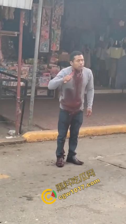 国外男子竟当街自残,刀割喉咙鲜血四溅,群众惊恐围观,男子倒地不省人事,惨烈一幕令人心悸胆战!-8