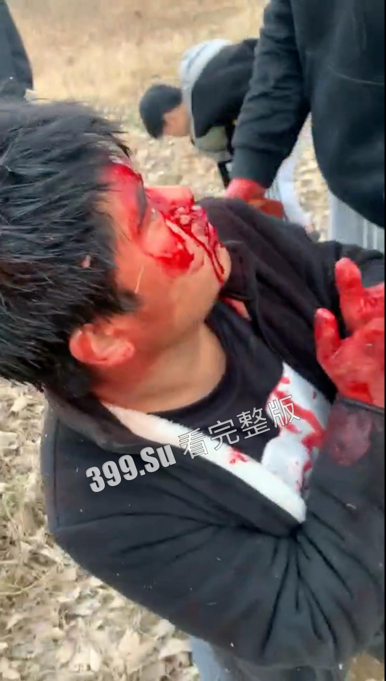 慎点!!!猎奇之私刑 无视法律,自己用暴力来惩罚-7