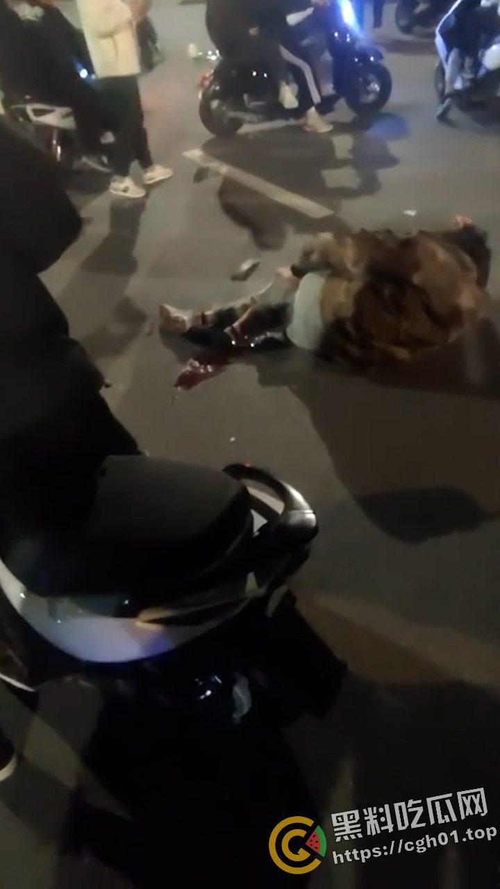 桂林野仔半夜飙车 把路人小腿撞断后没钱赔 有钱买鬼火 没钱擦屁股 现场血腥视频流出-3